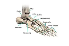 Ayak Tarak Kemiği Çatlağı Belirtileri ve Tedavisi