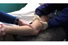 Dirsek Çatlağı Belirtileri ve Tedavisi